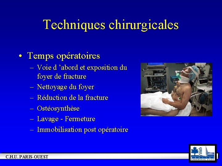 Techniques chirurgicales • Temps opératoires – Voie d ’abord et exposition du foyer de