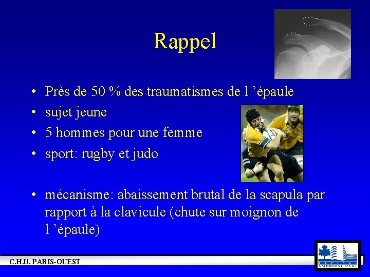 Rappel • • Près de 50 % des traumatismes de l ’épaule sujet jeune