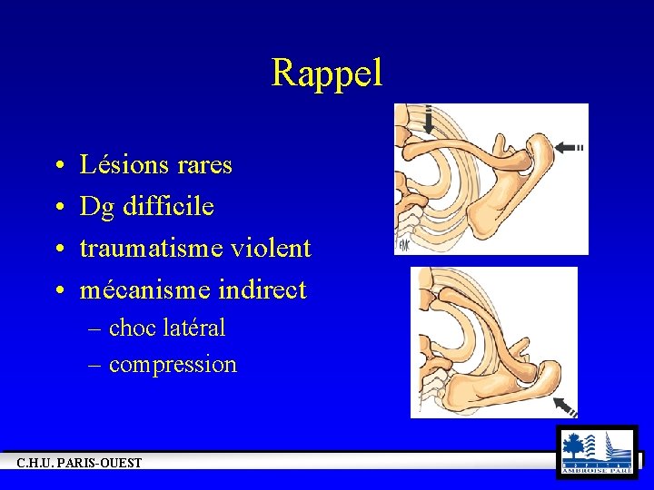 Rappel • • Lésions rares Dg difficile traumatisme violent mécanisme indirect – choc latéral