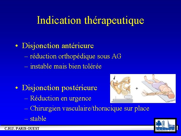 Indication thérapeutique • Disjonction antérieure – réduction orthopédique sous AG – instable mais bien