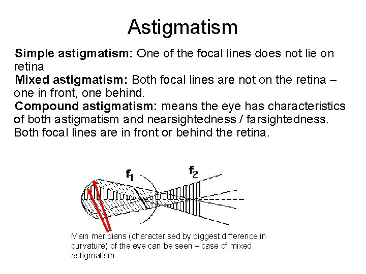 Astigmatism Simple astigmatism: One of the focal lines does not lie on retina Mixed