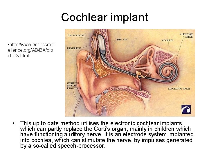 Cochlear implant • http: //www. accessexc ellence. org/AB/BA/bio chip 3. html • This up