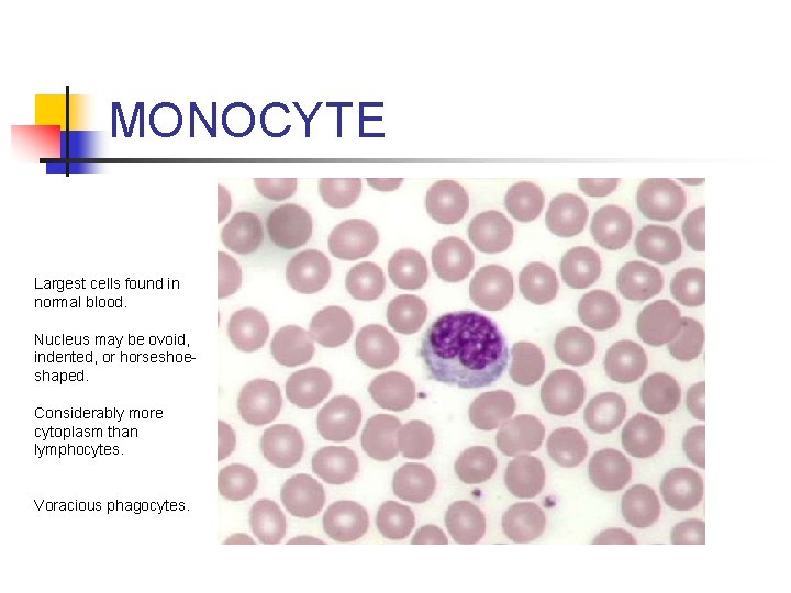 MONOCYTE Largest cells found in normal blood. Nucleus may be ovoid, indented, or horseshoeshaped.