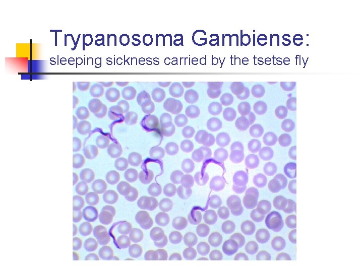 Trypanosoma Gambiense: sleeping sickness carried by the tsetse fly 