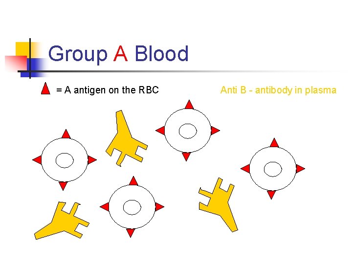 Group A Blood = A antigen on the RBC Anti B - antibody in