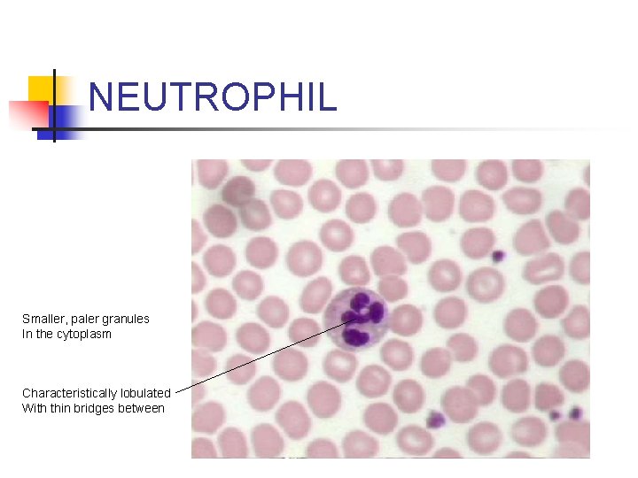 NEUTROPHIL Smaller, paler granules In the cytoplasm Characteristically lobulated With thin bridges between 
