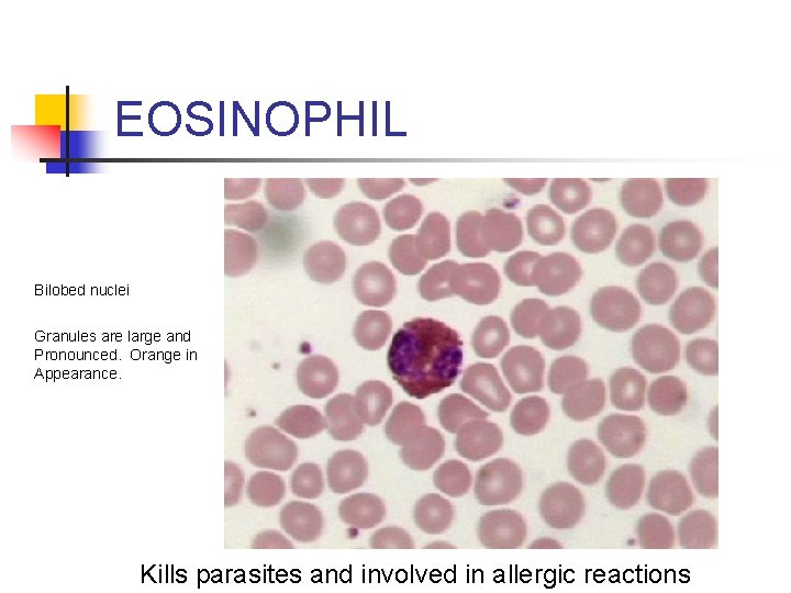 EOSINOPHIL Bilobed nuclei Granules are large and Pronounced. Orange in Appearance. Kills parasites and