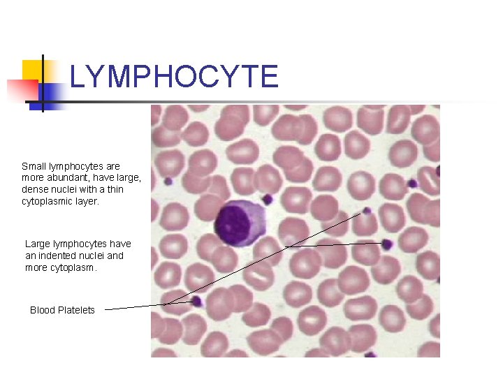 LYMPHOCYTE Small lymphocytes are more abundant, have large, dense nuclei with a thin cytoplasmic