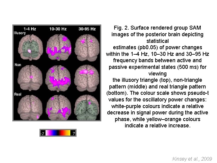 Fig. 2. Surface rendered group SAM images of the posterior brain depicting statistical estimates