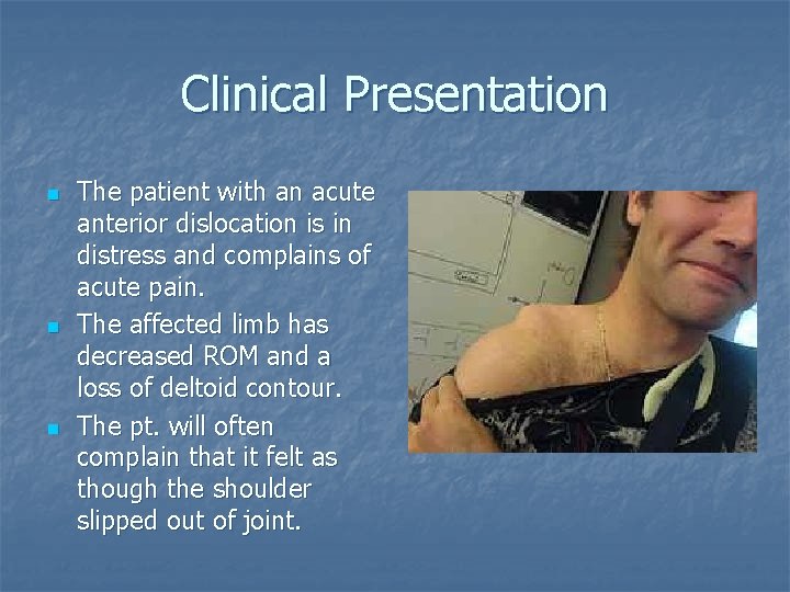 Clinical Presentation n The patient with an acute anterior dislocation is in distress and