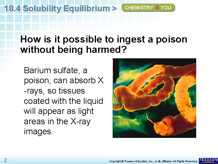 18. 4 Solubility Equilibrium > CHEMISTRY & YOU How is it possible to ingest