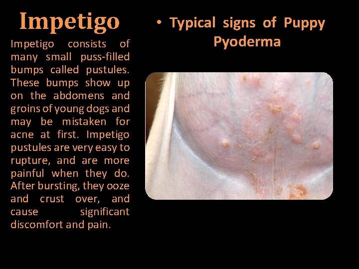 Impetigo consists of many small puss-filled bumps called pustules. These bumps show up on