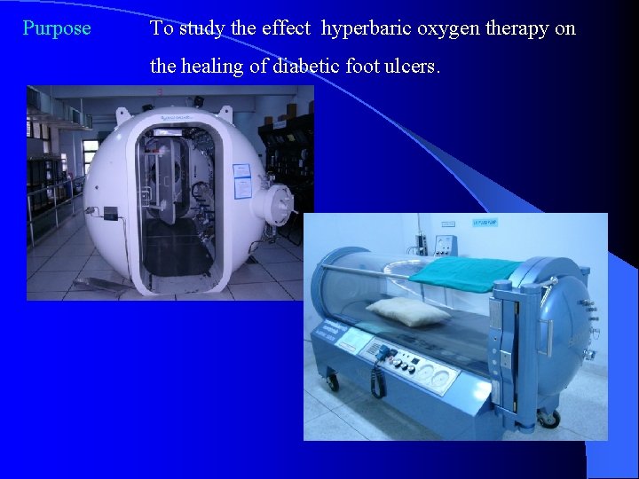 Purpose To study the effect hyperbaric oxygen therapy on the healing of diabetic foot