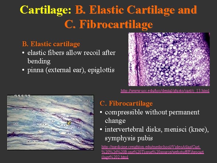 Cartilage: B. Elastic Cartilage and C. Fibrocartilage B. Elastic cartilage • elastic fibers allow