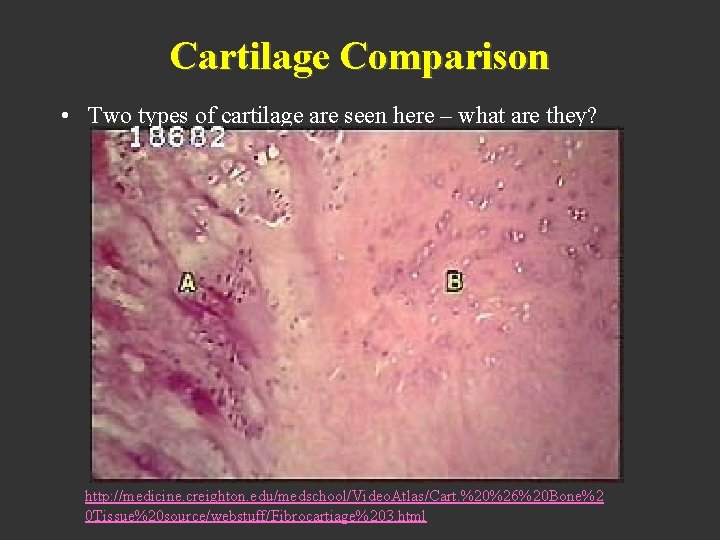 Cartilage Comparison • Two types of cartilage are seen here – what are they?