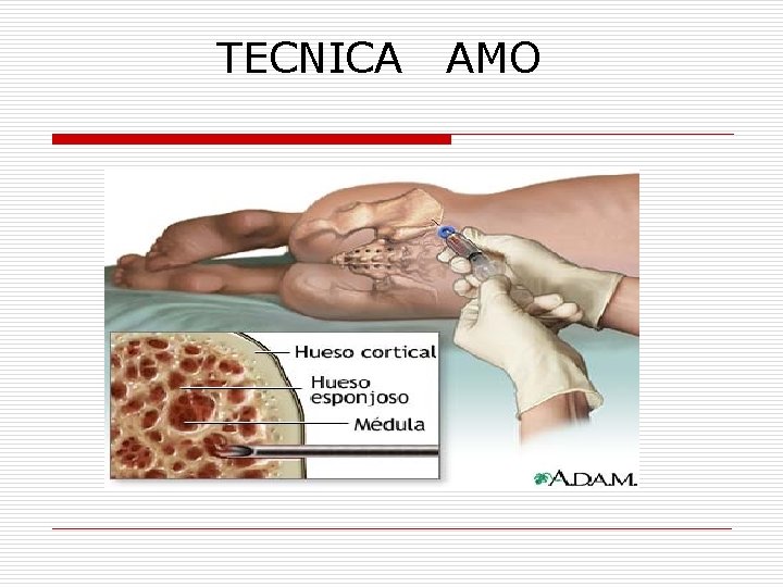 TECNICA AMO 