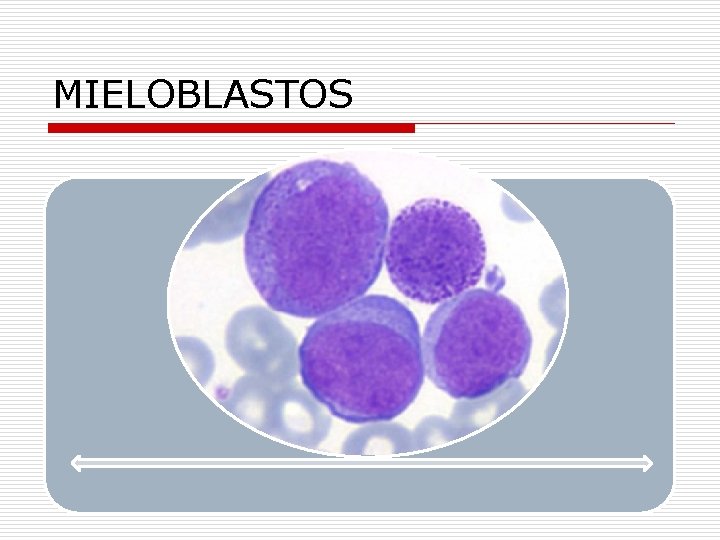 MIELOBLASTOS 