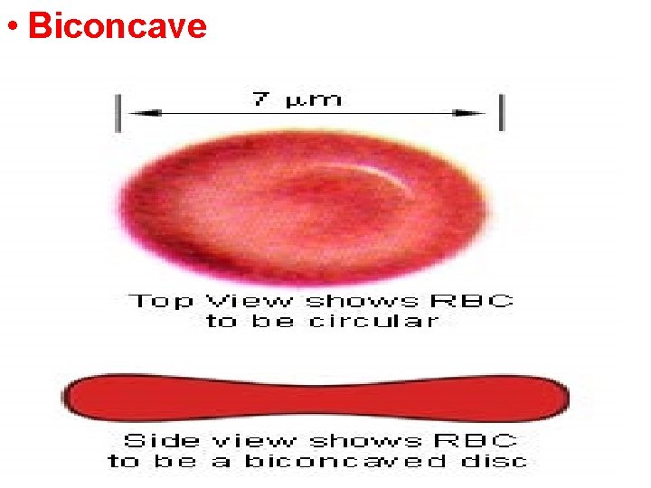  • Biconcave 