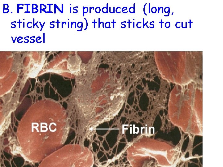 B. FIBRIN is produced (long, sticky string) that sticks to cut vessel 