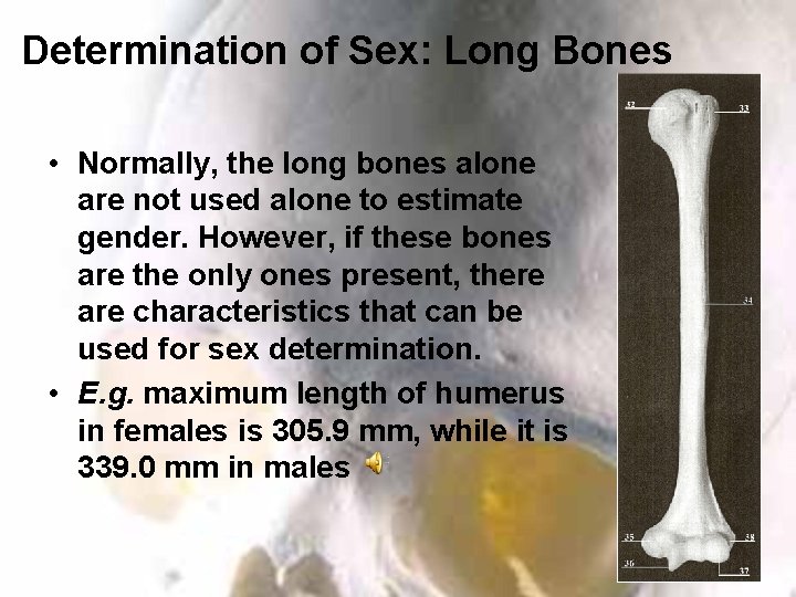 Determination of Sex: Long Bones • Normally, the long bones alone are not used