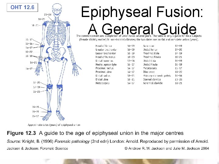 Epiphyseal Fusion: A General Guide 