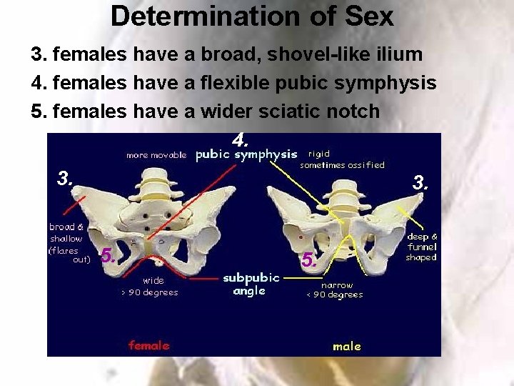 Determination of Sex 3. females have a broad, shovel-like ilium 4. females have a