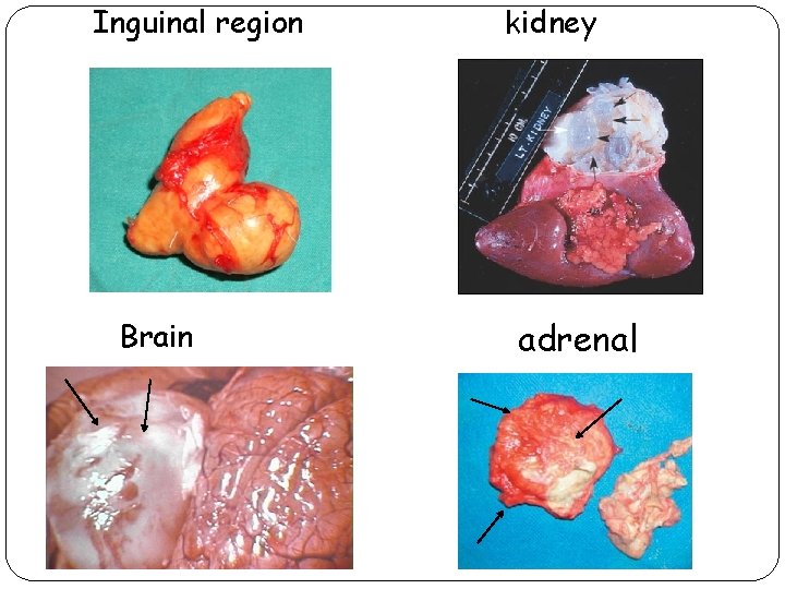 Inguinal region Brain kidney adrenal 