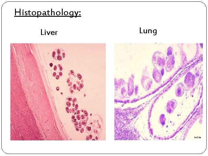 Histopathology: Liver Lung 