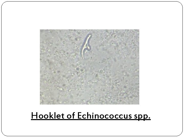 Hooklet of Echinococcus spp. 