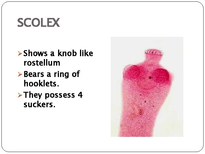 SCOLEX Ø Shows a knob like rostellum Ø Bears a ring of hooklets. Ø