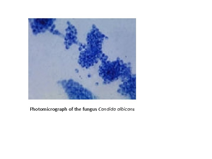 Photomicrograph of the fungus Candida albicans 