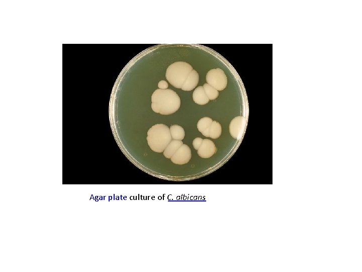 Agar plate culture of C. albicans 