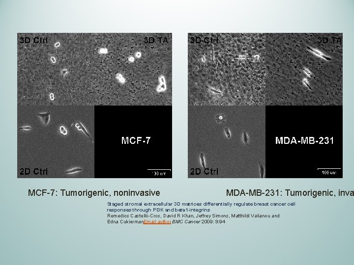 MCF-7: Tumorigenic, noninvasive MDA-MB-231: Tumorigenic, inva Staged stromal extracellular 3 D matrices differentially regulate