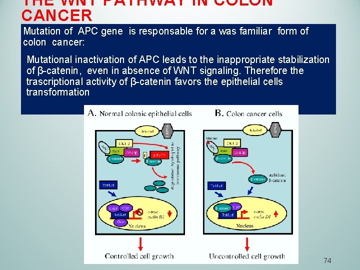 THE WNT PATHWAY İN COLON CANCER Mutation of APC gene is responsable for a