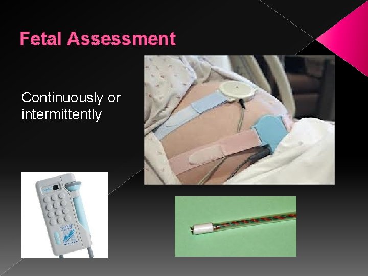 Fetal Assessment Continuously or intermittently 