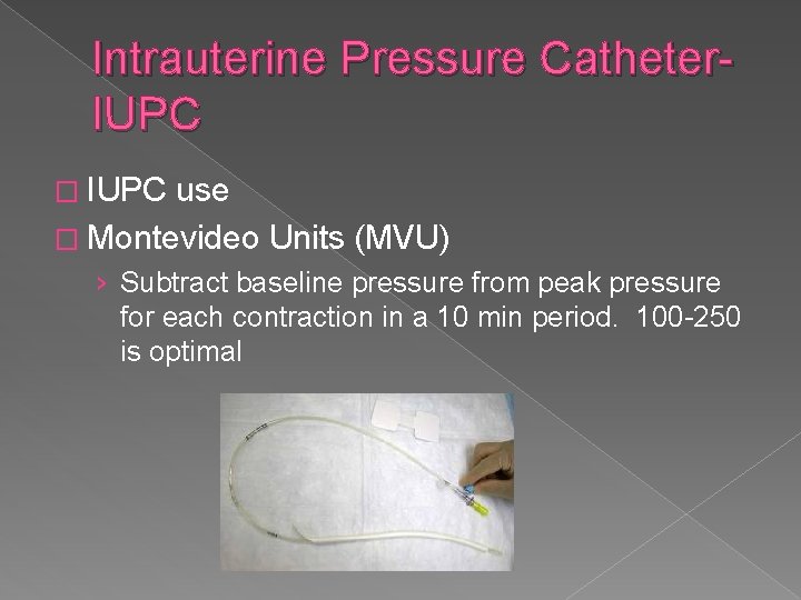 Intrauterine Pressure Catheter. IUPC � IUPC use � Montevideo Units (MVU) › Subtract baseline