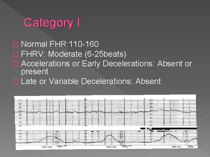 Category I Normal FHR: 110 -160 FHRV: Moderate (6 -25 beats) Accelerations or Early