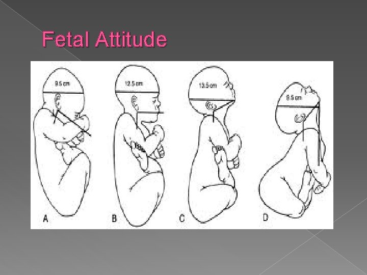 Fetal Attitude 
