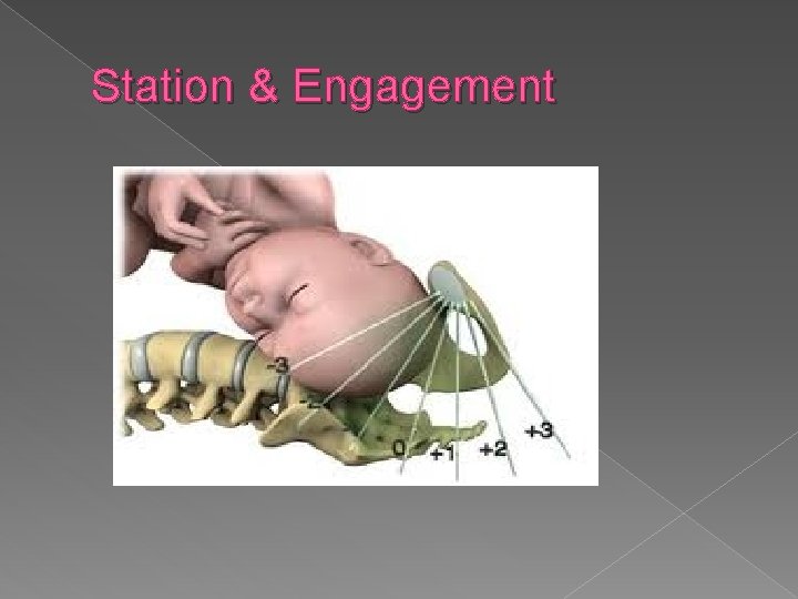 Station & Engagement 