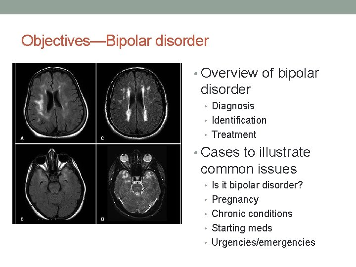 Objectives—Bipolar disorder • Overview of bipolar disorder • Diagnosis • Identification • Treatment •