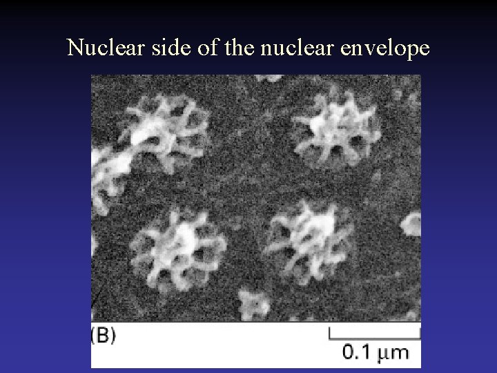 Nuclear side of the nuclear envelope 