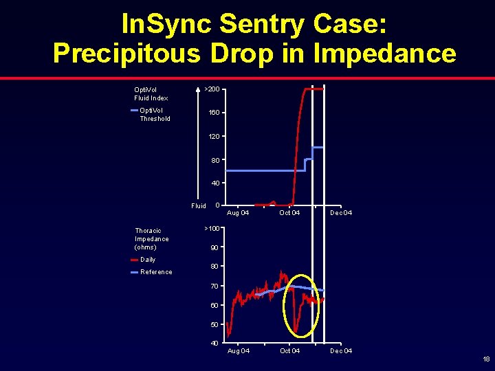 In. Sync Sentry Case: Precipitous Drop in Impedance Opti. Vol Fluid Index >200 Opti.