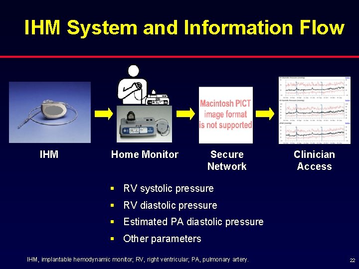 IHM System and Information Flow IHM Home Monitor Secure Network Clinician Access § RV
