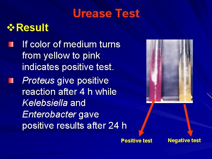 Urease Test v. Result If color of medium turns from yellow to pink indicates