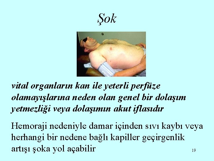 Şok vital organların kan ile yeterli perfüze olamayışlarına neden olan genel bir dolaşım yetmezliği