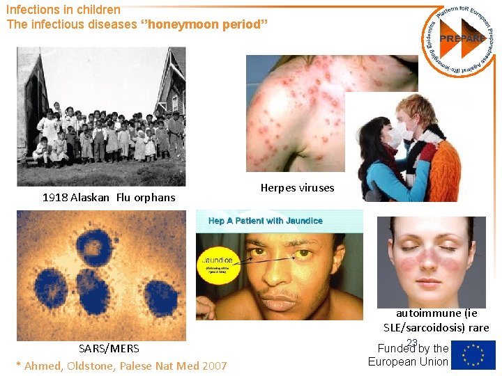 Infections in children The infectious diseases ‘’honeymoon period’’ 1918 Alaskan Flu orphans Herpes viruses