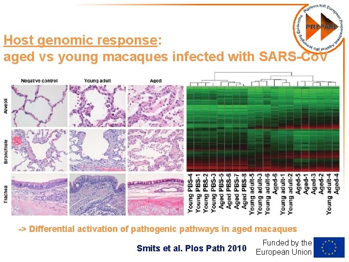 Host genomic response: aged vs young macaques infected with SARS-Co. V -> Differential activation