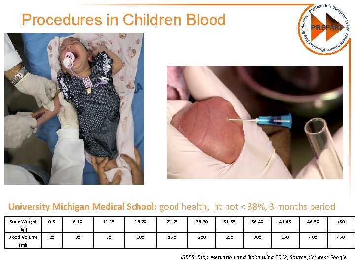 Procedures in Children Blood University Michigan Medical School: good health, ht not < 38%,