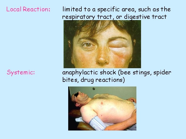 Local Reaction: limited to a specific area, such as the respiratory tract, or digestive