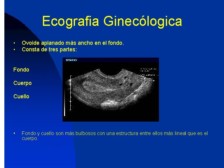 Ecografia Ginecólogica • • Ovoide aplanado más ancho en el fondo. Consta de tres